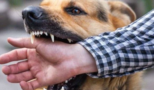 Người đàn ông 63 tuổi tử vong sau khi bị chó cắn lúc tập thể dục