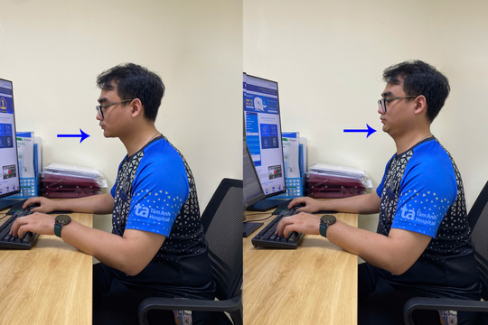 Ba bài tập giảm mỏi cổ vai gáy tại bàn cho dân văn phòng