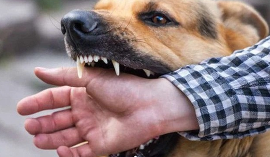 Sự cố thương tâm: Cụ ông 83 tuổi tử vong do chó nuôi trong nhà tấn công