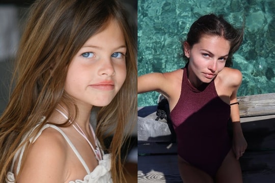 Kiếm 4,2 triệu USD ở tuổi 25 nhờ danh xưng 'cô gái đẹp nhất thế giới'