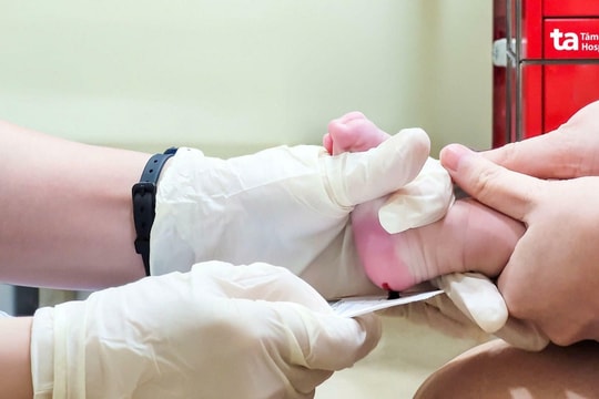 Có nên xét nghiệm máu gót chân cho trẻ sơ sinh không?