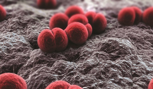 Viêm màng não mô cầu "sát thủ 24 giờ", bác sĩ cảnh báo nguy cơ