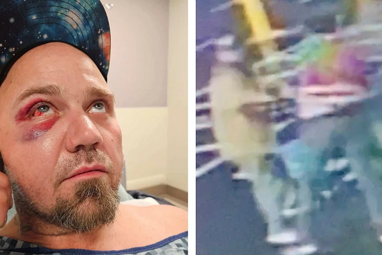 Kẻ trộm kiện ngược nhân viên siêu thị vì bị đuổi đánh