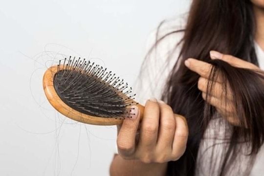 Rụng nhiều tóc có phải dấu hiệu suy giáp?