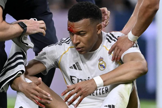 Mbappe khâu 3 mũi trên trán sau va chạm