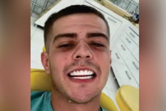 Kẻ buôn ma túy bị bắt vì gửi ảnh 'khoe răng' cho bạn