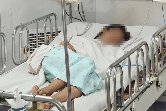 Những dấu hiệu bệnh não mô cầu dễ bỏ qua