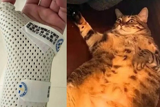 Bị mèo nặng 7,5 kg 'đè' khi ngủ, cô gái gãy xương cổ tay