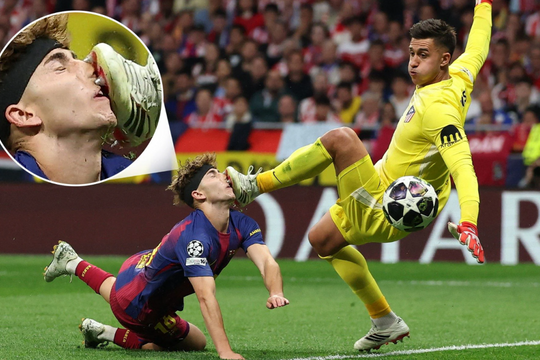 Tiền vệ Barca đổ máu sau khi bị đá vào mặt