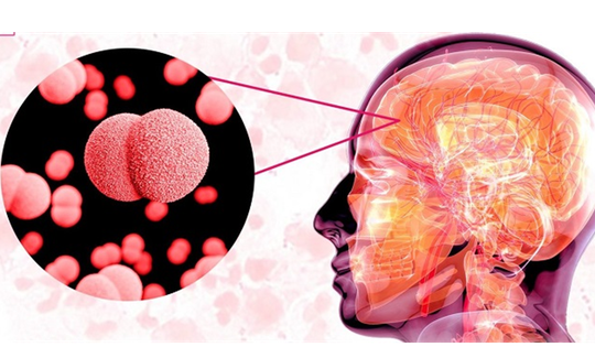 Bệnh nguy hiểm đã có 4 ca không qua khỏi, Viện Pasteur Tp.HCM cảnh báo