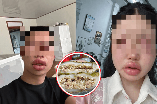 Tò mò ăn bánh trứng kiến theo TikTok khiến nhiều người dị ứng