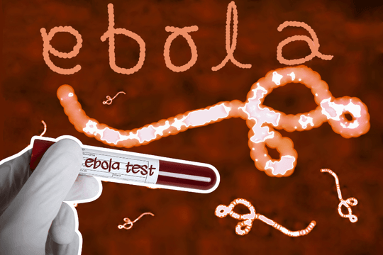 Bộ Y tế cập nhật hướng dẫn chẩn đoán và điều trị bệnh do virus Ebola năm 2026