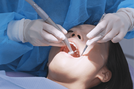 Nghiên cứu mới hé lộ viêm khoang miệng có thể làm suy giảm khả năng sinh sản ở phụ nữ