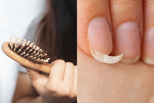 Rụng tóc, chuột rút, móng dễ gãy: Cơ thể đang thiếu chất hay chỉ vì quá căng thẳng?