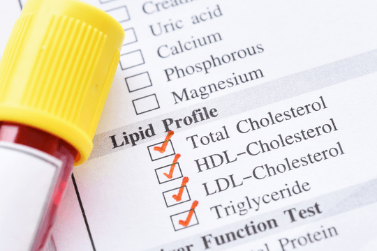 LDL-C, HDL-C, triglyceride là gì? Giải ngố 3 chỉ số thường gặp trên phiếu xét nghiệm mỡ máu