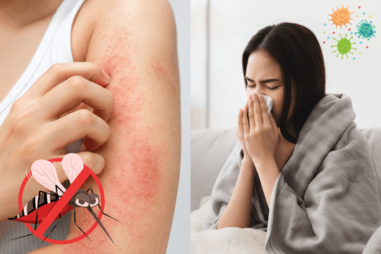 Sốt xuất huyết, cúm và sốt siêu vi khác nhau như thế nào?