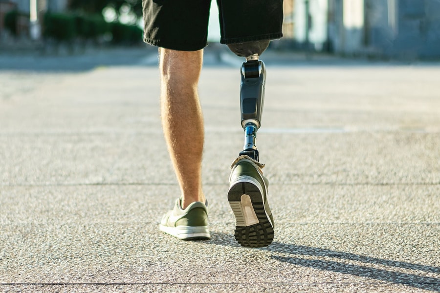 Khi cắt mất đi một bộ phận, não bộ chúng ta không nhận ra điều đó