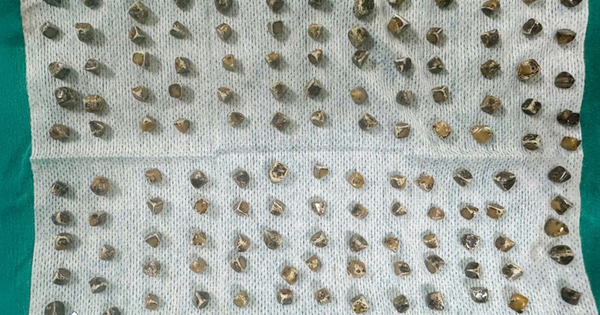 Người phụ nữ 40 tuổi đau bụng, buồn nôn, bác sĩ sốc nặng khi phát hiện "bí mật đáng sợ"