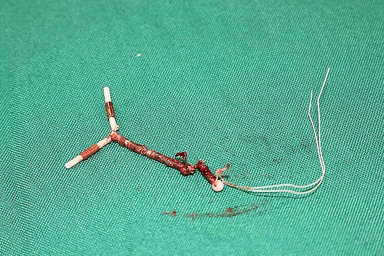 Đánh đổi sức khỏe để giữ 'phong độ' cho chồng