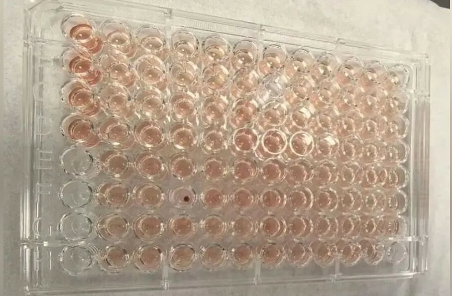 Phát hiện người mang 'máu kim cương' ở Trung Quốc