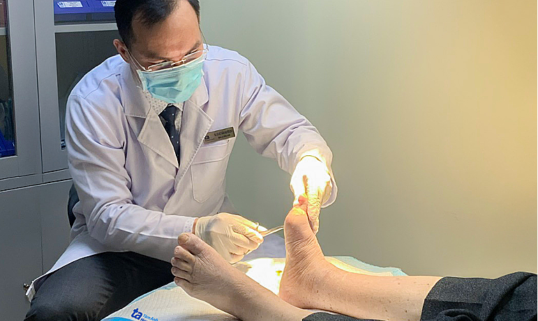 Bàn chân nhiễm trùng do biến chứng tiểu đường