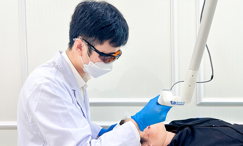 Bắn laser làm nhạt màu vết bớt sắc tố