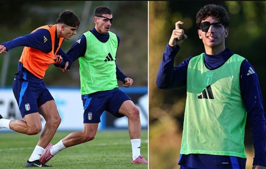 Cầu thủ Italy bịt một mắt khi tập luyện