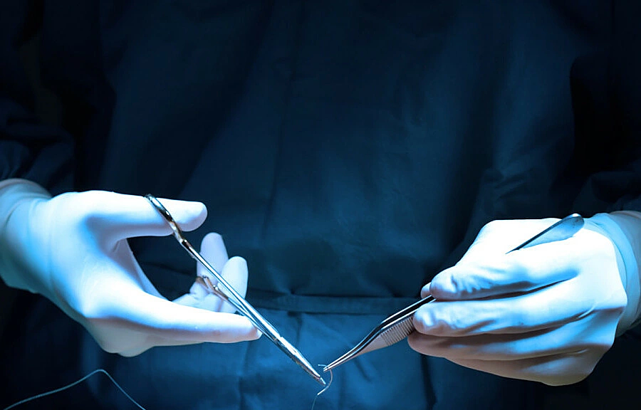 Nhiễm trùng sau gắn bi vào bao quy đầu