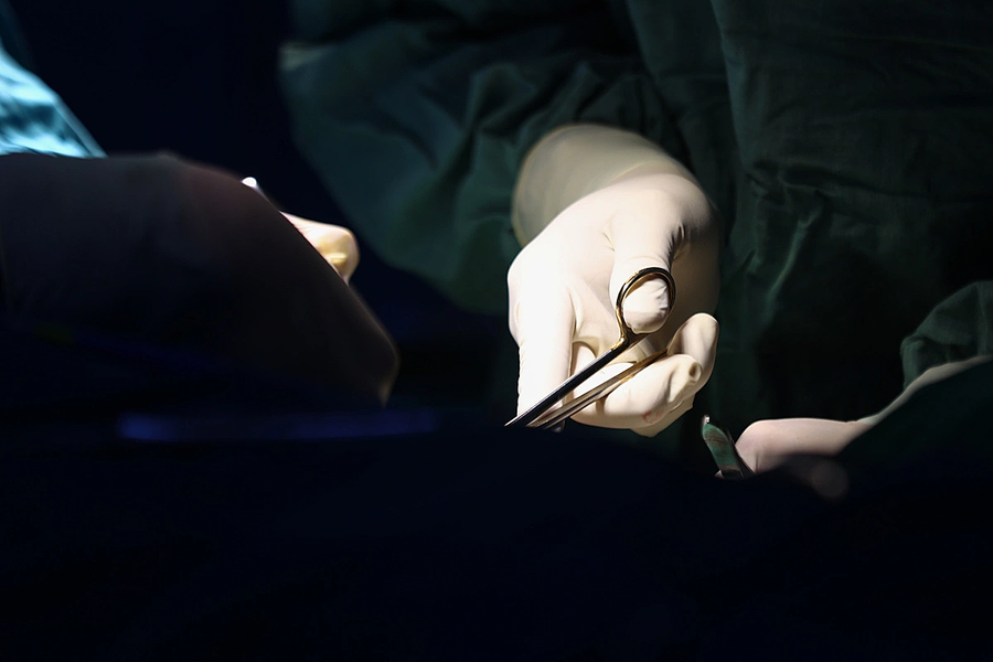 Vỡ tử cung sau tự phá thai 27 tuần