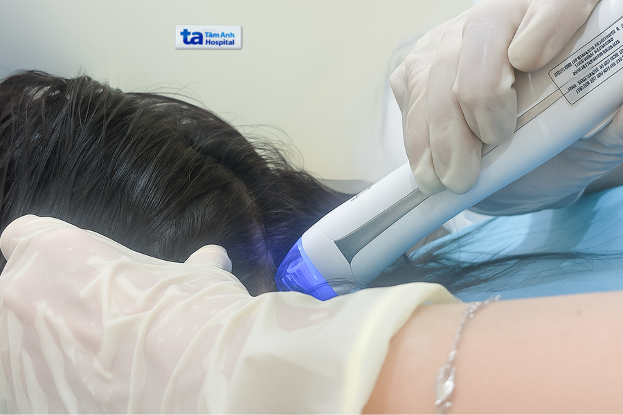 Bạc tóc tuổi đôi mươi do da đầu lão hóa sớm