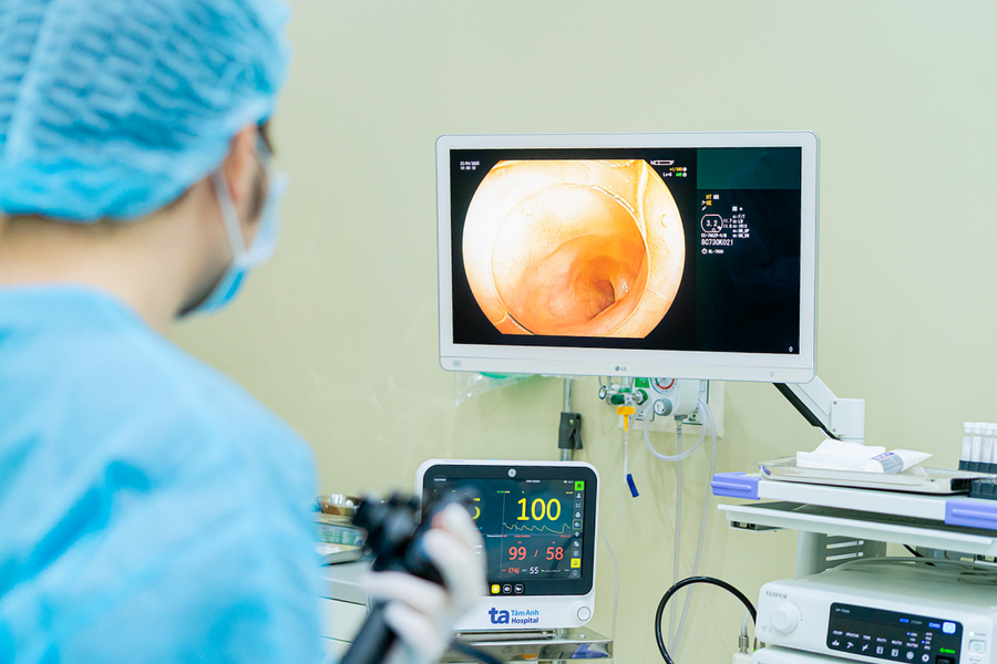 Những mốc thời gian nên nội soi đại tràng