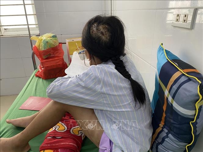 Phẫn nộ vụ việc cha dượng dùng búa đinh đánh vào đầu bé gái 9 tuổi