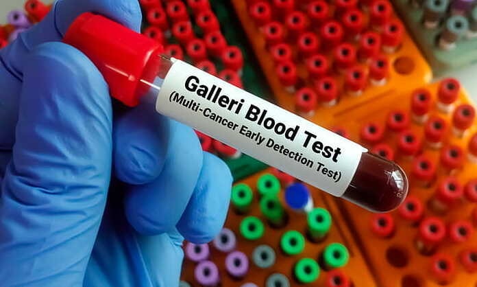 Xét nghiệm máu mới có thể phát hiện sớm hơn 50 loại ung thư