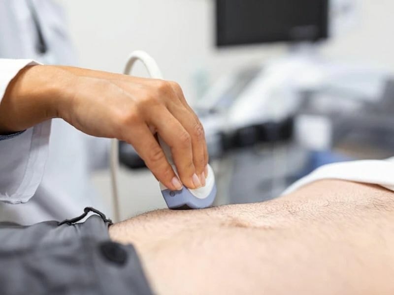 Siêu âm ổ bụng có cần nhịn ăn?