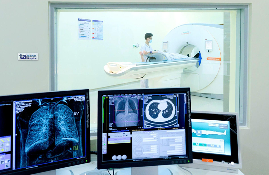 Các thời điểm nên tầm soát ung thư phổi