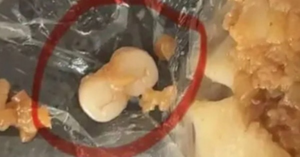 Người dân sốc nặng khi phát hiện răng người trong xúc xích, dimsum