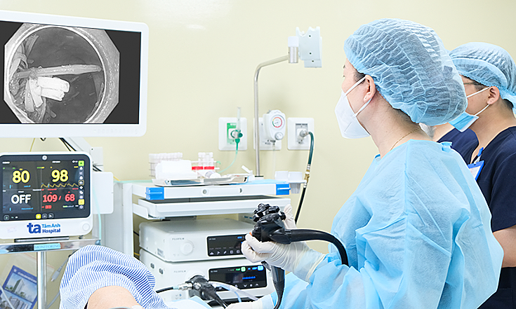 Nội soi gắp cây tăm ở dạ dày người đàn ông