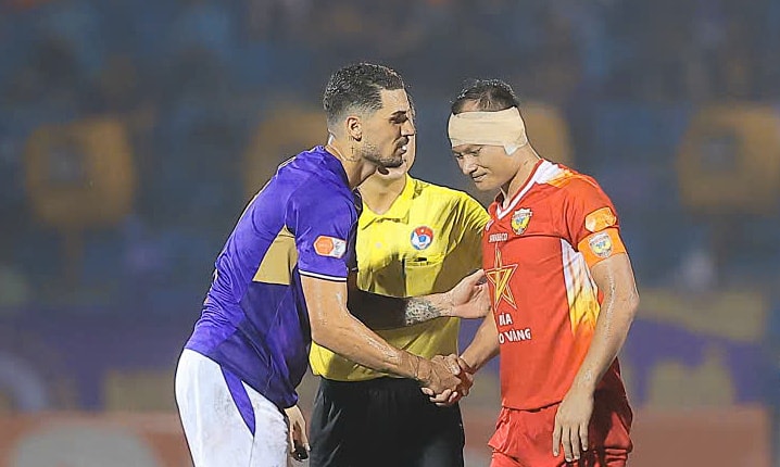 Cựu tuyển thủ Việt Nam bị giẫm rách tai ở V-League