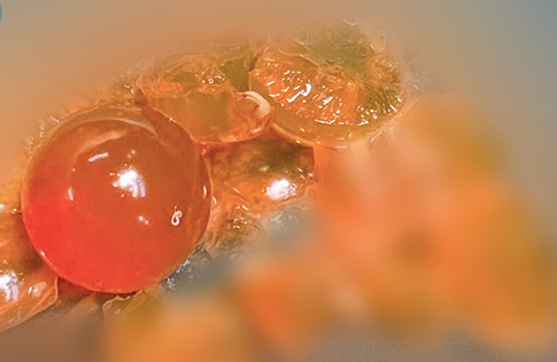 Bé trai 14 tháng tuổi nuốt nhầm hạt nở