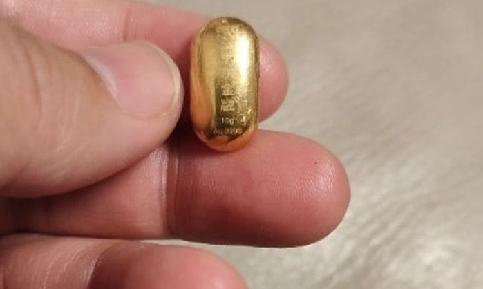 Bé trai 11 tuổi nuốt hạt đậu vàng 10 gram để 'rèn lưỡi'