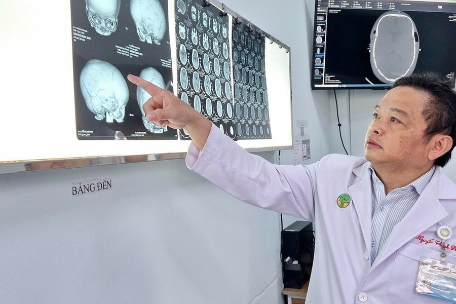 Ca mổ 5 giờ giúp bé gái 1 tuổi thoát đầu méo