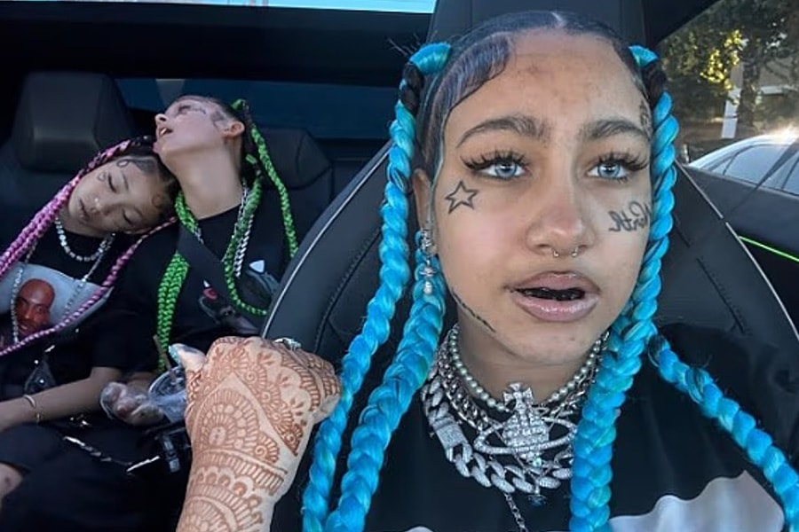 Nha sĩ cảnh báo mốt răng đen kiểu 'con gái Kim Kardashian'