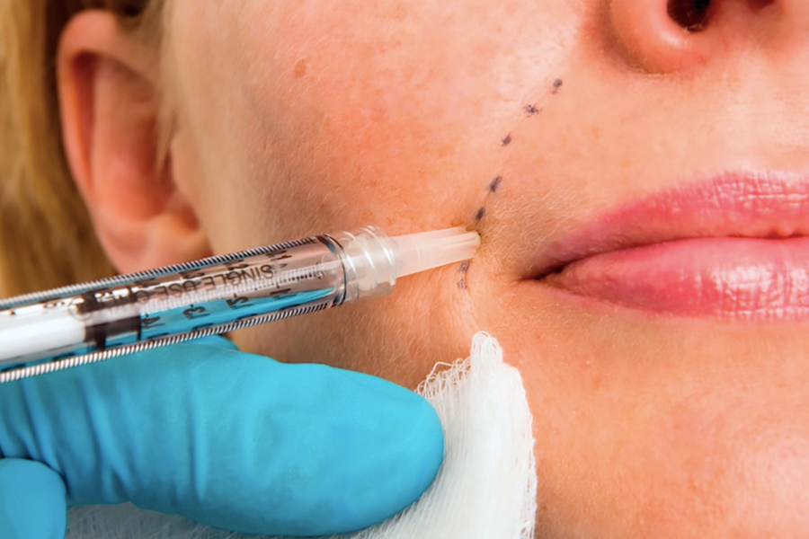 Botox - 'thần dược' xóa nhăn hay độc dược gây liệt người?