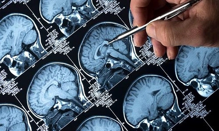 Những thói quen tưởng vô hại có thể gây đột quỵ khi trời lạnh