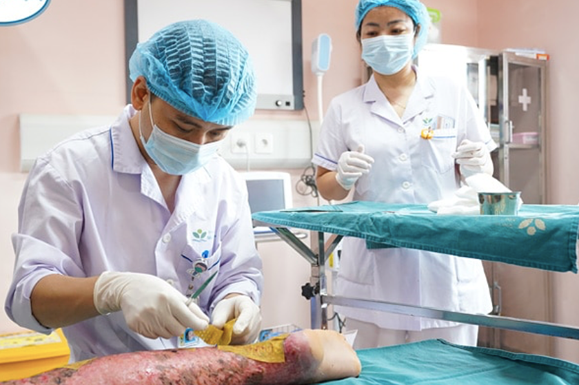 Lửa đốt cồn bùng cháy khiến bé trai bỏng nặng