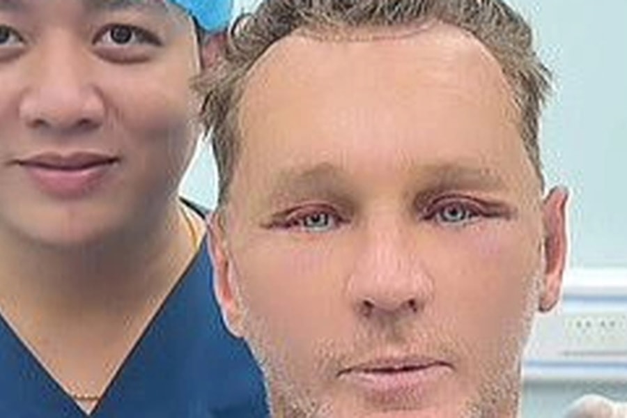 Khách Tây đổi đời sau khi tới Việt Nam phẫu thuật thẩm mỹ