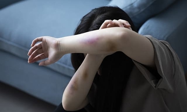 Tranh cãi 'có tội hay không' khi khiến bạn gái tự tử sau cãi vã căng thẳng