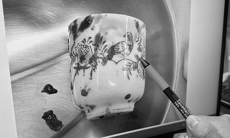 Người đàn ông hoại tử ruột vì chiếc cốc sứ trong hậu môn