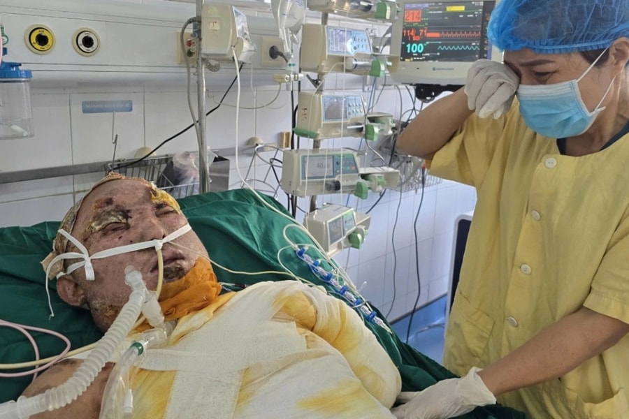 Mẹ ung thư đổ gục khi con trai bỏng điện bất động giữa ranh giới sinh tử