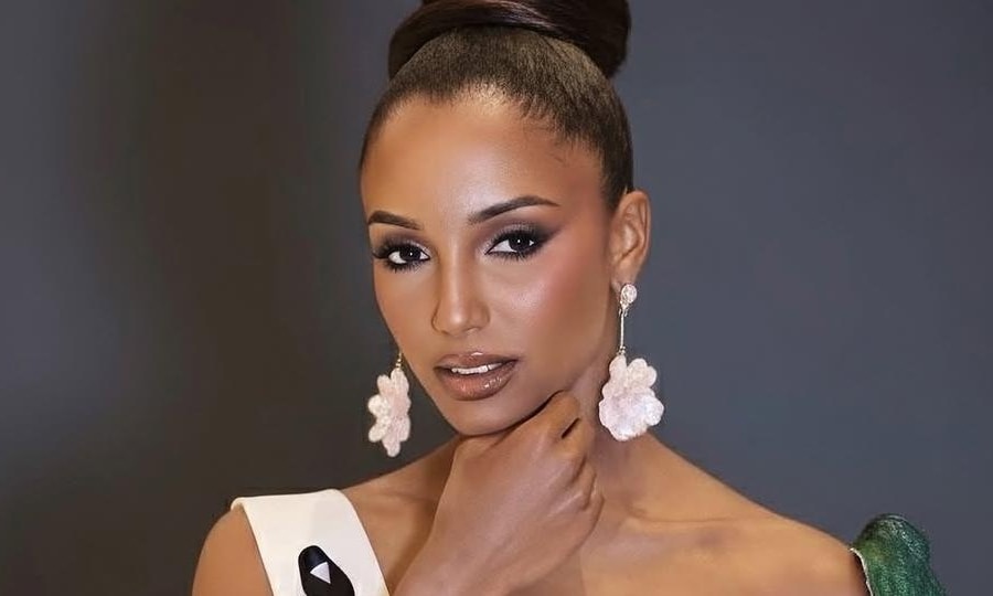 Tình trạng đáng lo của thí sinh bị tai nạn tại Hoa hậu Hoàn vũ